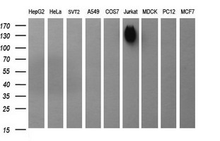 CD45 / LCA Antibody - Western blot of extracts (35 ug) from 9 different cell lines by using anti-PTPRC monoclonal antibody (HepG2: human; HeLa: human; SVT2: mouse; A549: human; COS7: monkey; Jurkat: human; MDCK: canine; PC12: rat; MCF7: human).