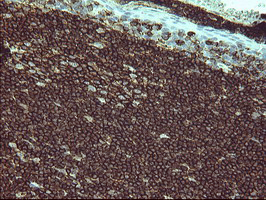 CD45 / LCA Antibody - IHC of paraffin-embedded Human lymph node tissue using anti-PTPRC mouse monoclonal antibody.