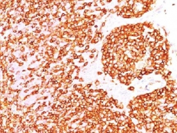CD45 / LCA Antibody - IHC test of FFPE human tonsil probed with CD45 antibody (clone PTPRC/1460). Required HIER: boil tissue sections in 10mM citrate buffer, pH 6, for 10-20 min.