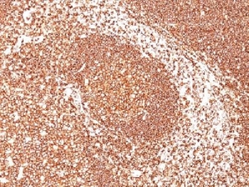 CD45 / LCA Antibody - IHC test of FFPE human tonsil probed with CD45 antibody (clone PTPRC/1461). Required HIER: boil tissue sections in 10mM citrate buffer, pH 6, for 10-20 min.
