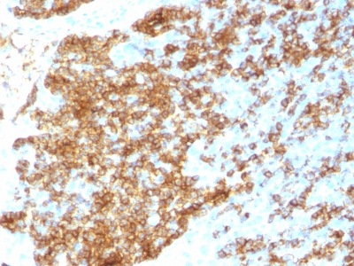 CD45 / LCA Antibody - Formalin-fixed paraffin-embedded human Tonsil stained with CD45RB Rabbit Recombinant Monoclonal Antibody (PTPRC/1783R).