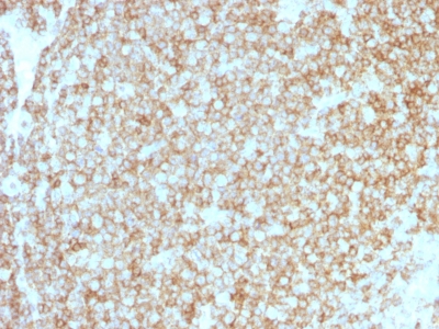 CD45 / LCA Antibody - Formalin-fixed, paraffin-embedded human Tonsil stained with CD45 Recombinant Rabbit Monoclonal Antibody (PTPRC/1783R + PTPRC/1975R).