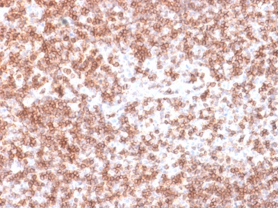 CD45 / LCA Antibody - Formalin-fixed, paraffin-embedded Human Lymph Node stained with CD45 Rabbit Recombinant Monoclonal Antibody (PTPRC/1975R).
