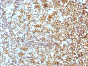 CD45 / LCA Antibody - IHC test of FFPE human tonsil probed with LCA antibody.  This image was taken for the unmodified form of this product. Other forms have not been tested.