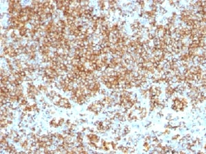 CD45 / LCA Antibody - IHC test of FFPE human tonsil probed with CD45 antibody cocktail.  This image was taken for the unmodified form of this product. Other forms have not been tested.