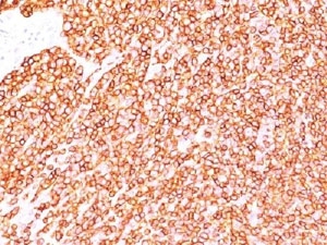 CD45 / LCA Antibody - IHC testing of FFPE human tonsil with anti-CD45 antibody.  This image was taken for the unmodified form of this product. Other forms have not been tested.