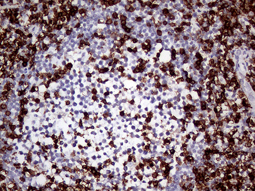 CD45 / LCA Antibody - Immunohistochemical staining of paraffin-embedded Human lymph node tissue within the normal limits using anti-CD45RO mouse monoclonal antibody. (Heat-induced epitope retrieval by 1mM EDTA in 10mM Tris buffer. (pH8.0) at 120°C for 3 min. (1:1000)