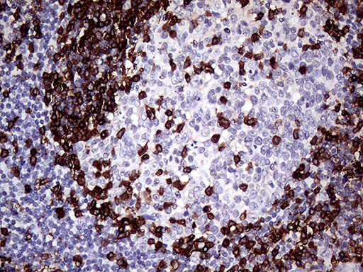 CD45 / LCA Antibody - Immunohistochemical staining of paraffin-embedded Human tonsil using anti-CD45RO mouse monoclonal antibody. (Heat-induced epitope retrieval by 1mM EDTA in 10mM Tris buffer. (pH8.0) at 120°C for 3 min). (1:1000)