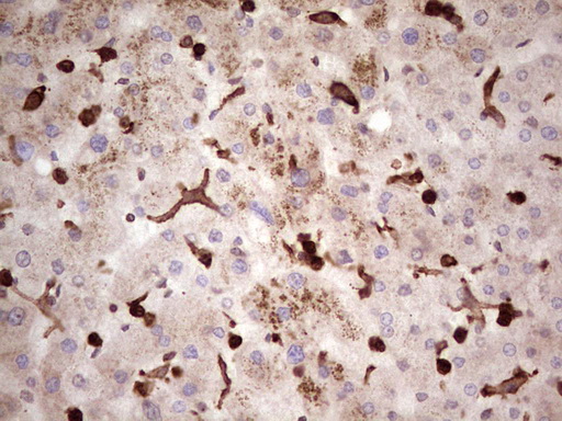 CD45 / LCA Antibody - IHC of paraffin-embedded Human liver tissue using anti-CD45RO mouse monoclonal antibody. (heat-induced epitope retrieval by 1 mM EDTA in 10mM Tris, pH8.5, 120°C for 3min).