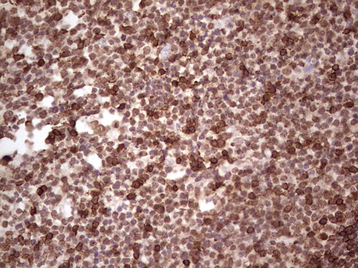 CD45 / LCA Antibody - IHC of paraffin-embedded Human tonsil using anti-CD45RO mouse monoclonal antibody. (heat-induced epitope retrieval by 1 mM EDTA in 10mM Tris, pH8.5, 120°C for 3min).