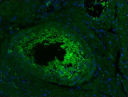 CD45 / LCA Antibody - Purified Anti-Human CD45R staining of paraformaldehyde-fixed paraffin-embedded human spleen sections at 400x magnification with DAPI counterstain. (Rat anti-human CD45R 1:500; Alexa Fluor 488 Goat anti-rat 1:500 (Molecular Probes) and Normal Goat Serum (blocking))