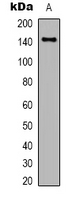 CD45 / LCA Antibody - Western blot analysis of CD45 expression in HeLa (A) whole cell lysates.