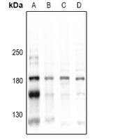 CD45 / LCA Antibody - Western blot analysis of CD45 (pY1216) expression in HEK293T (A), MCF7 (B), PC12 (C), AML12 (D) whole cell lysates.