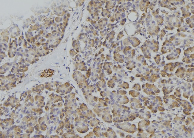 CD45 / LCA Antibody - 1:100 staining human pancreas tissue by IHC-P. The sample was formaldehyde fixed and a heat mediated antigen retrieval step in citrate buffer was performed. The sample was then blocked and incubated with the antibody for 1.5 hours at 22°C. An HRP conjugated goat anti-rabbit antibody was used as the secondary.