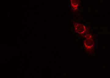 CD45 / LCA Antibody - Staining HeLa cells by IF/ICC. The samples were fixed with PFA and permeabilized in 0.1% Triton X-100, then blocked in 10% serum for 45 min at 25°C. The primary antibody was diluted at 1:200 and incubated with the sample for 1 hour at 37°C. An Alexa Fluor 594 conjugated goat anti-rabbit IgG (H+L) Ab, diluted at 1/600, was used as the secondary antibody.