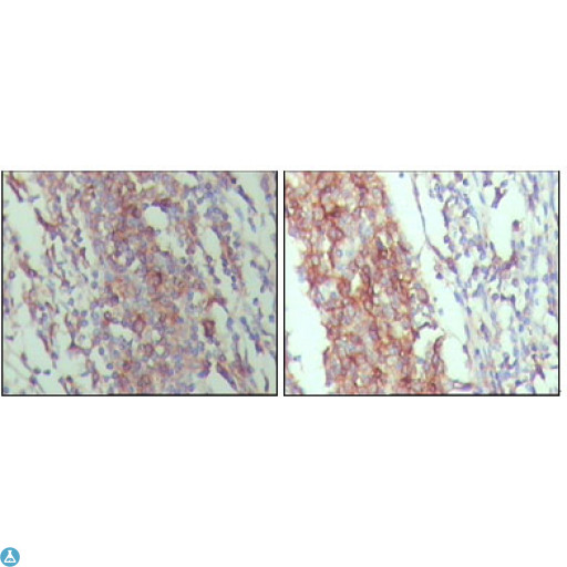 CD45 / LCA Antibody - Immunohistochemistry (IHC) analysis of paraffin-embedded Human Lymph node tissue, showing membrane and cytoplasmic localization with DAB staining using CD45 Monoclonal Antibody.