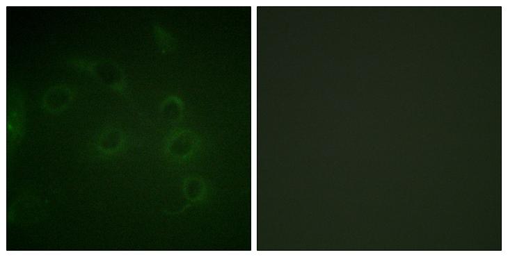 CD45 / LCA Antibody - Peptide - + Immunofluorescence analysis of HuvEc cells, using CD45 antibody.