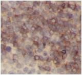CD45 / LCA Antibody - Immunohistochemistry of paraffin-embedded human tonsillitis tissue slide using CD45 antibody at dilution of 1:300. Heat mediated antigen retrieved with Tris-EDTA buffer (pH9).