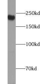 CD45 / LCA Antibody - Raji cells were subjected to SDS PAGE followed by western blot with CD45 antibody at dilution of 1:1000