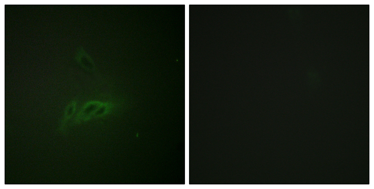 CD45 / LCA Antibody - Immunofluorescence analysis of HeLa cells, using CD45 (Phospho-Ser1007) Antibody. The picture on the right is blocked with the phospho peptide.