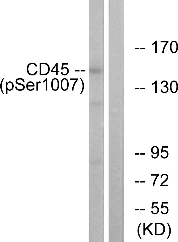 CD45 / LCA Antibody - Western blot analysis of lysates from HeLa cells treated with TNF 20ng/ml 15', using CD45 (Phospho-Ser1007) Antibody. The lane on the right is blocked with the phospho peptide.