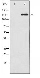 CD45 / LCA Antibody - Western blot of CD45 phosphorylation expression in TNF treated HeLa whole cell lysates,The lane on the left is treated with the antigen-specific peptide.