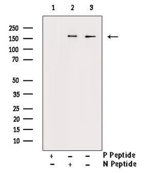 CD45 / LCA Antibody - Western blot analysis of Phospho-CD45 (Ser1007) antibody expression in TNF treated HeLa cells lysates. The lane on the right is treated with the antigen-specific peptide.