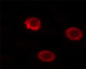 CD45 / LCA Antibody - Staining HeLa cells by IF/ICC. The samples were fixed with PFA and permeabilized in 0.1% saponin prior to blocking in 10% serum for 45 min at 37°C. The primary antibody was diluted 1/400 and incubated with the sample for 1 hour at 37°C. A Alexa Fluor® 594 conjugated goat polyclonal to rabbit IgG (H+L), diluted 1/600 was used as secondary antibody.