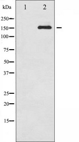 CD45 / LCA Antibody - Western blot analysis of CD45 phosphorylation expression in TNF treated HeLa whole cells lysates. The lane on the left is treated with the antigen-specific peptide.