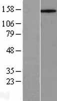 CD45 / LCA Protein - Western validation with an anti-DDK antibody * L: Control HEK293 lysate R: Over-expression lysate