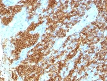 CD45RA Antibody - IHC test of FFPE human tonsil probed with CD45RA antibody.  This image was taken for the unmodified form of this product. Other forms have not been tested.
