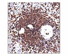 CD45RA Antibody - CD45RA antibody 158-4D3 immunohistochemistry spleen This image was taken for the unmodified form of this product. Other forms have not been tested.