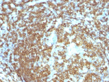 CD45RA Antibody - IHC testing of human spleen stained with 158-4D3 mAb.