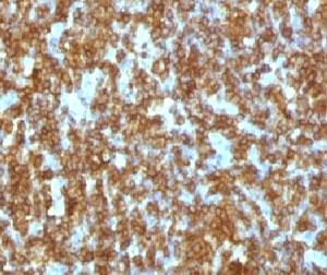 CD45RA Antibody - IHC testing of FFPE human tonsil and anti-CD45RA antibody (CDLA45RA-1).  This image was taken for the unmodified form of this product. Other forms have not been tested.