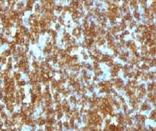 CD45RA Antibody - IHC testing of FFPE human tonsil and anti-CD45RA antibody (CDLA45RA-1).  This image was taken for the unmodified form of this product. Other forms have not been tested.