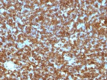 CD45RA Antibody - IHC test of FFPE human tonsil probed with CD45RA antibody