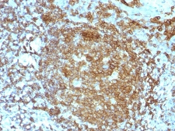 CD45RA Antibody - IHC test of FFPE human tonsil probed with CD45RA antibody.  This image was taken for the unmodified form of this product. Other forms have not been tested.