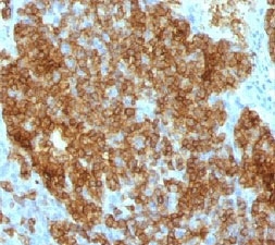 CD45RA Antibody - IHC test of FFPE human tonsil probed with anti-CD45RA antibody.  This image was taken for the unmodified form of this product. Other forms have not been tested.