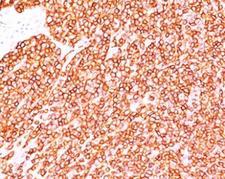 CD45RB Antibody - CD45RB antibody BRA-11 immunohistochemistry tonsil.  This image was taken for the unmodified form of this product. Other forms have not been tested.