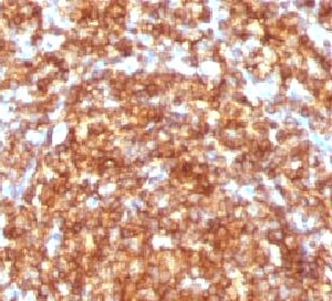 CD45RB Antibody - IHC testing of FFPE human tonsil and CD45RB antibody (clone CDLA45RB-1).  This image was taken for the unmodified form of this product. Other forms have not been tested.