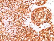 CD45RB Antibody - IHC test of FFPE human tonsil probed with CD45RB antibody.  This image was taken for the unmodified form of this product. Other forms have not been tested.
