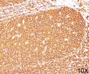 CD45RB Antibody - CD45RB antibody PD7/26 immunohistochemistry tonsil 10X.  This image was taken for the unmodified form of this product. Other forms have not been tested.
