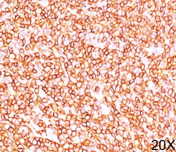 CD45RB Antibody - CD45RB antibody PD7/26 immunohistochemistry tonsil 20X.  This image was taken for the unmodified form of this product. Other forms have not been tested.