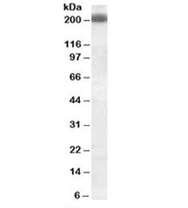 CD45RB Antibody - Western blot testing of Daudi cell lysate with CD45RB antibody (clone PD7/26). Predicted molecular weight: ~147/180~220kDa (unmodified/glycosylated). This image was taken for the unmodified form of this product. Other forms have not been tested.