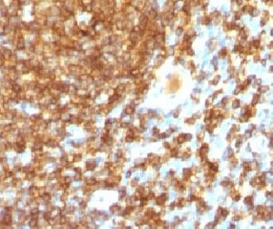 CD45RB Antibody - IHC test of FFPE human tonsil probed with CD45RB antibody (PTPRC/1132).  This image was taken for the unmodified form of this product. Other forms have not been tested.