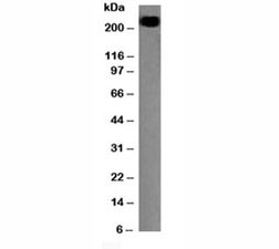 CD45RB Antibody - Western blot testing of CD45RB antibody and Daudi lysate.  This image was taken for the unmodified form of this product. Other forms have not been tested.