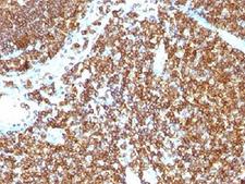 CD45RB Antibody - IHC testing of CD45RB antibody and FFPE human tonsil.  This image was taken for the unmodified form of this product. Other forms have not been tested.