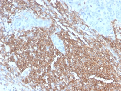 CD45RB Antibody - Formalin-fixed, paraffin-embedded human Lymph Node stained with CD45RB Rabbit Recombinant Monoclonal Antibody (PTPRC/2877R).