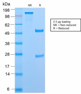 CD45RB Antibody - SDS-PAGE Analysis Purified CD45RB Rabbit Recombinant Monoclonal Antibody (PTPRC/2877R). Confirmation of Purity and Integrity of Antibody.