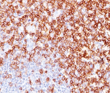 CD45RO Antibody - CD45RO antibody UCHL-1 immunohistochemistry tonsil.  This image was taken for the unmodified form of this product. Other forms have not been tested.